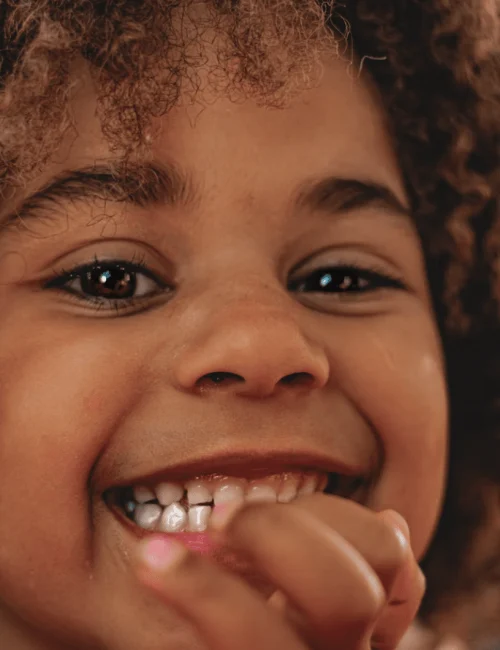 CHILDREN AND DENTAL CARE AMSTERDAM